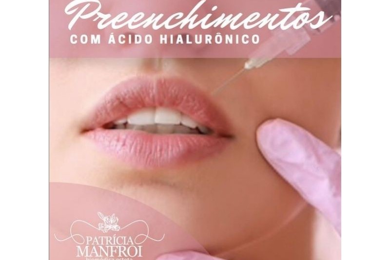 Preenchimento com Ácido Hialurônico em Porto Alegre: Harmonização Facial