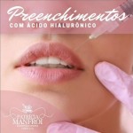 Preenchimento com Ácido Hialurônico em Porto Alegre: Harmonização Facial