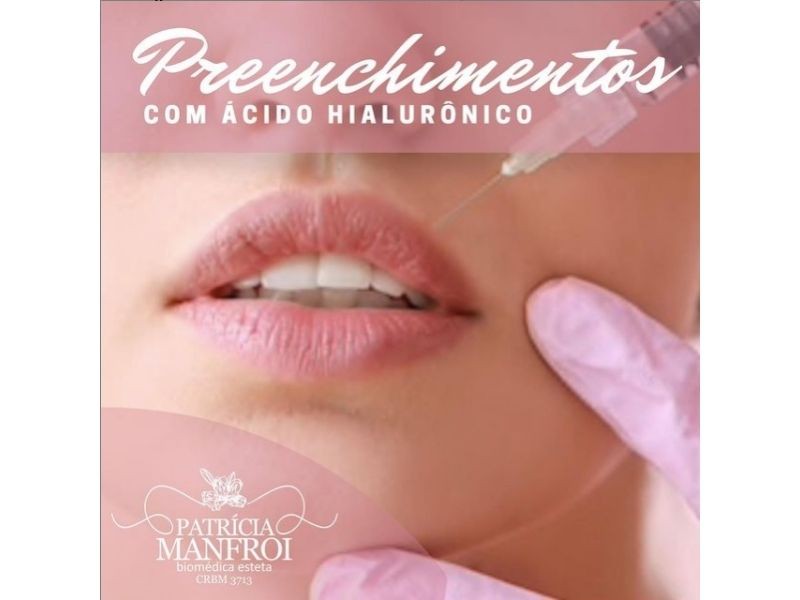Preenchimento com Ácido Hialurônico em Porto Alegre: Harmonização Facial